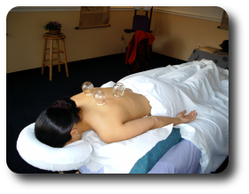 Cupping is useful for a wide range of external and internal disorders.