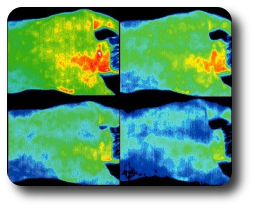 Infrared imaging studies show the almost immediate effect of an acupuncture treatment for pain.